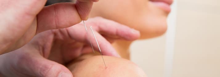 Acupuncture in Anderson OH Acupuncture in Anderson OH